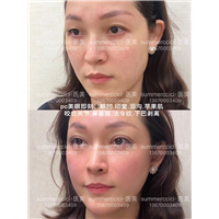 pc美眼即刻效果 