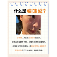 被欧阳娜娜带火的猫咪纹是什么？