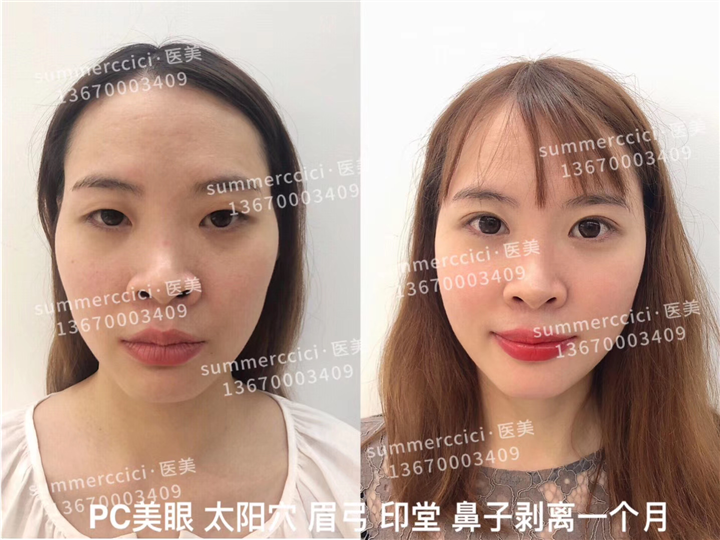pc美眼1个月 