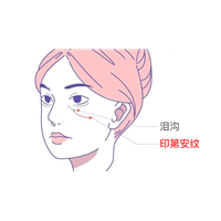 印第安纹怎么才能消除？按  摩针灸方法有用吗？