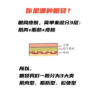 【眼袋大揭秘】让你快速摆脱眼袋困扰！