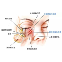 印第安纹用什么填充好？有什么风险和不良情况吗？