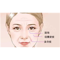 因长胖而出现的印第安纹瘦了会消失吗