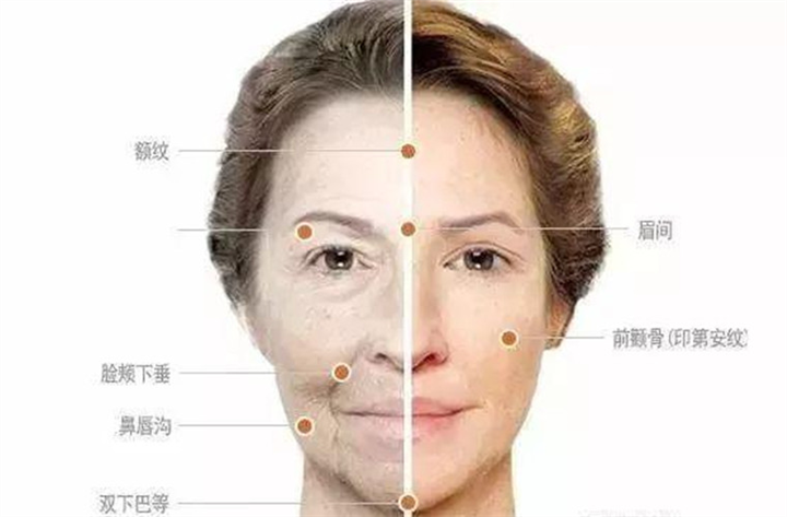 印第安纹怎么去除？去除方法怎么选？