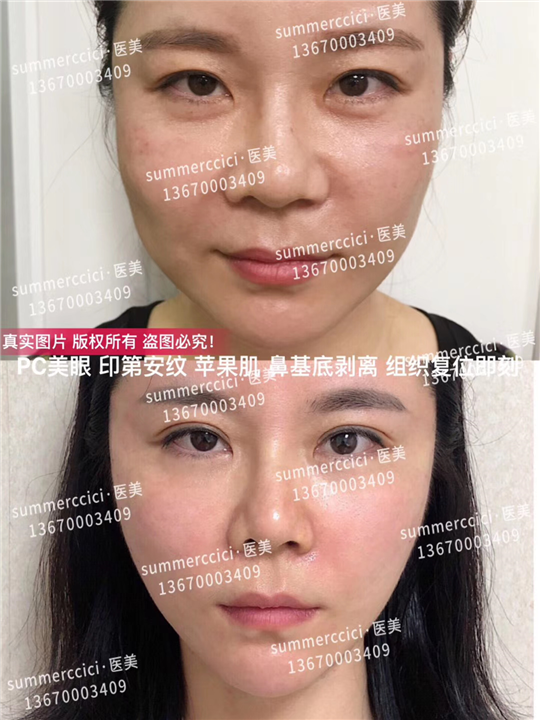 pc美眼 