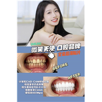 杭州哪里做牙贴面好