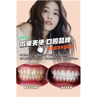 杭州做全瓷贴面哪家好
