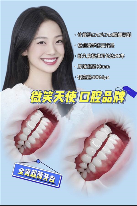 杭州牙贴面多少钱一颗