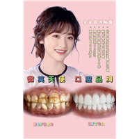 杭州做全瓷贴面哪家好