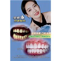 杭州做全瓷贴面哪家好