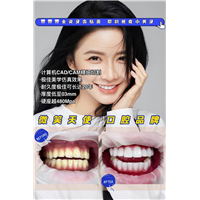 杭州牙贴面哪里好