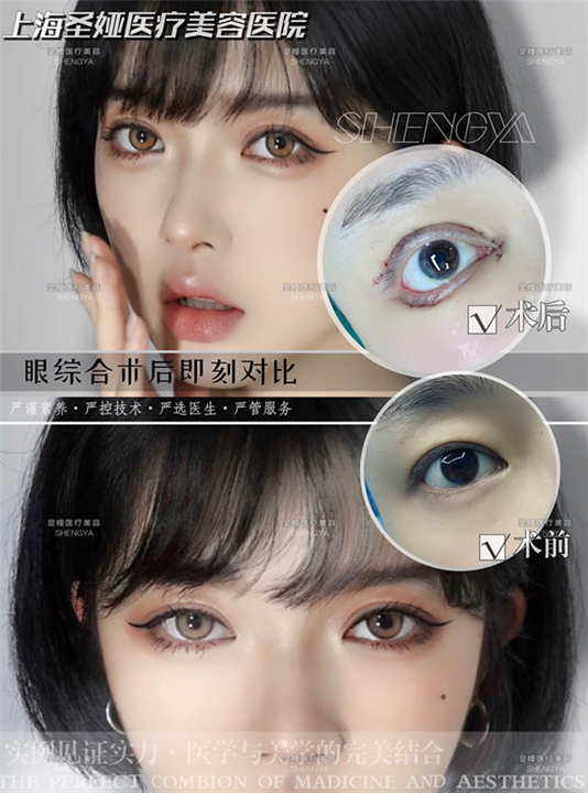 上海眼综合整形医院