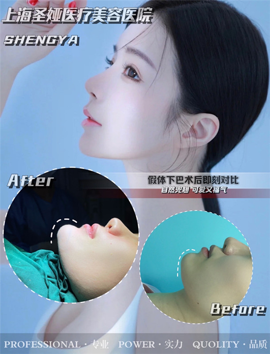 上海网红整形医院