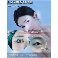上海高级脸打造