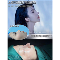 沪上整形医院哪家好