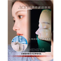 上海圣娅整形医院怎么样