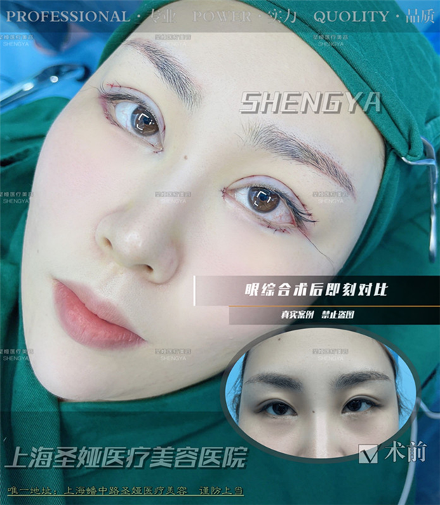 上海圣娅整形医院地址