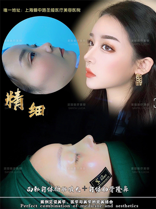 上海圣娅整形医院地址