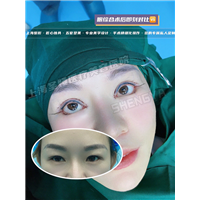 上海做眼综合整形哪家好