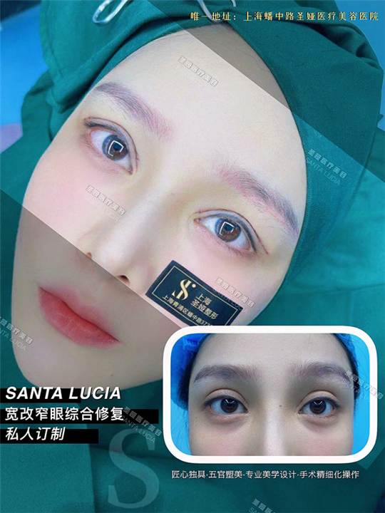 上海圣娅整形医院地址