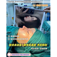 成都鼻综合整形