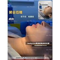成都吸脂整形医院