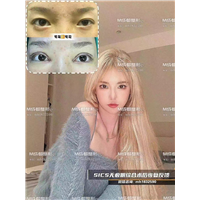 成都无痕眼综合