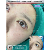 成都眼修复整形医院