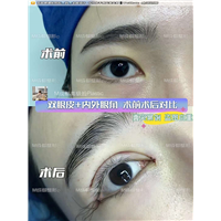 成都眼修复整形医院