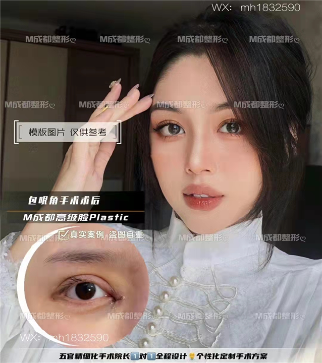 成都眼综合整形