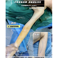 成都吸脂整形医院