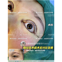 成都眼修复整形医院