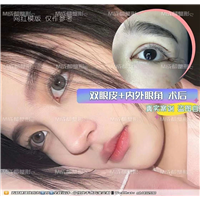 成都眼修复整形医院
