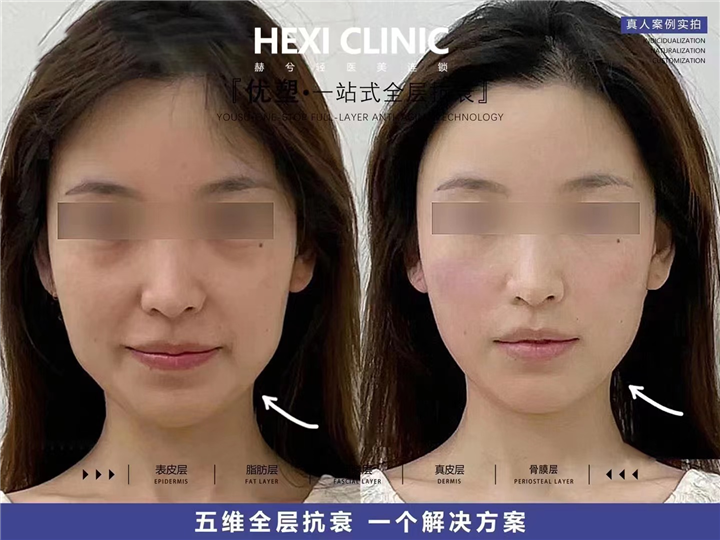 赫兮轻医美连锁
