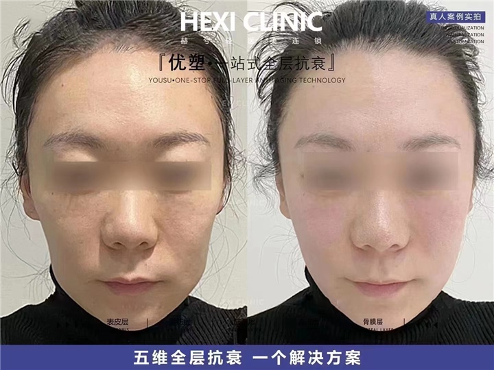 长沙赫兮轻医美抗衰