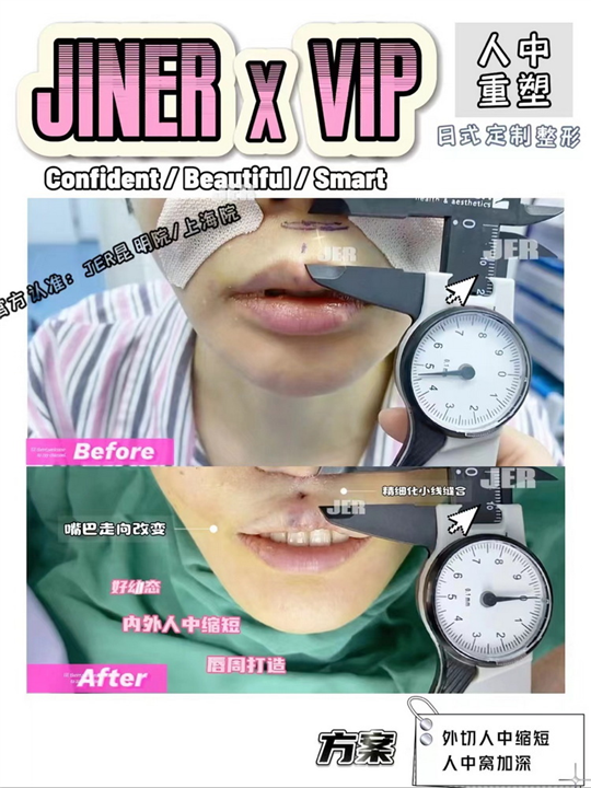 JINER医疗美容