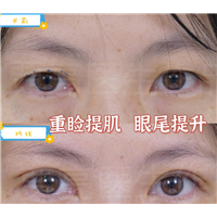 你知道双眼皮凭什么就比单眼皮好看吗？