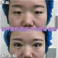 贾亮医生