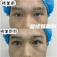 贾亮医生