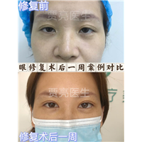 贾亮医生