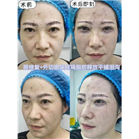 贾亮医生