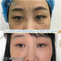 贾亮医生