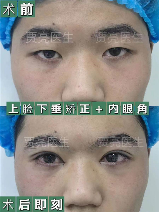 贾亮医生