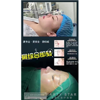 蒜头鼻的特征就是鼻头大