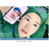 眼部案例