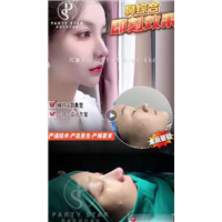 鼻综合案例