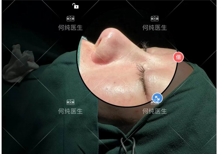 广州何纯医生