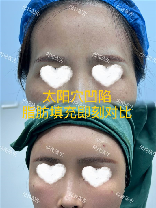 何纯整形医生