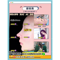 上海鼻整形专家