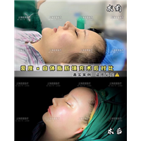 上海鼻整形医生
